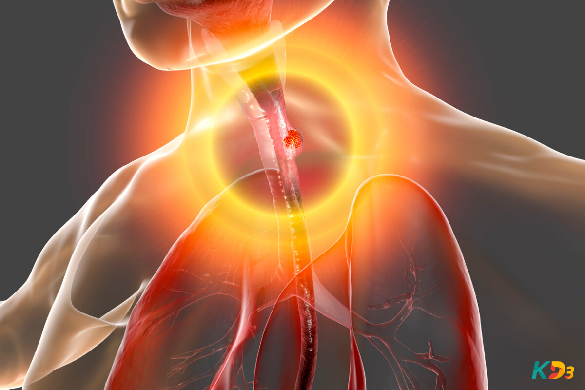 Deficiência de vitamina D: descubra 5 consequências que colocam a sua vida em risco